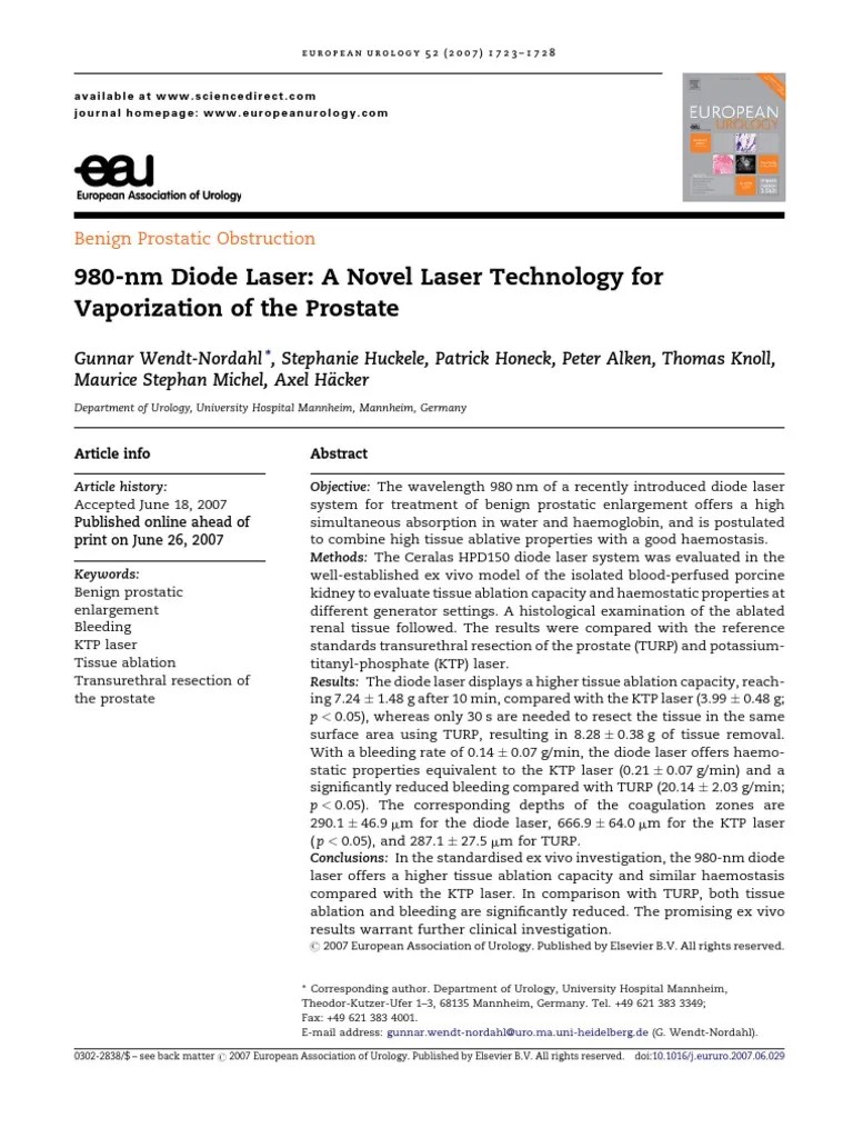 980 Nm Diode Laser A Novel Laser Technology For