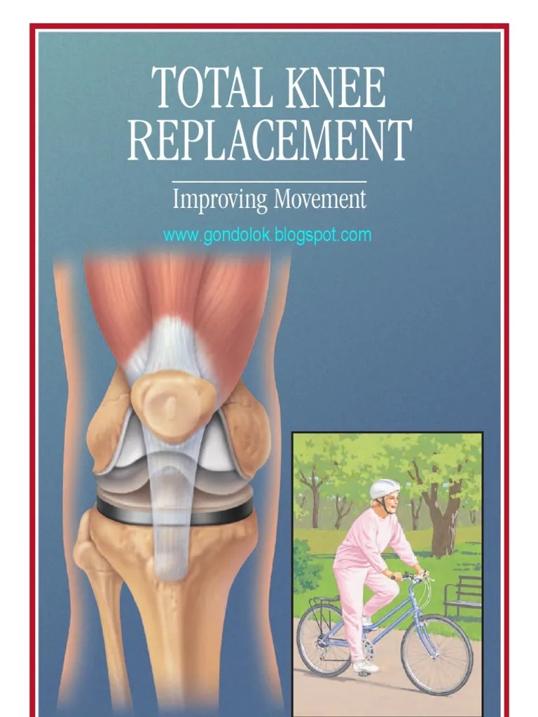 Knee Replacement Total | PDF | Knee | Surgery