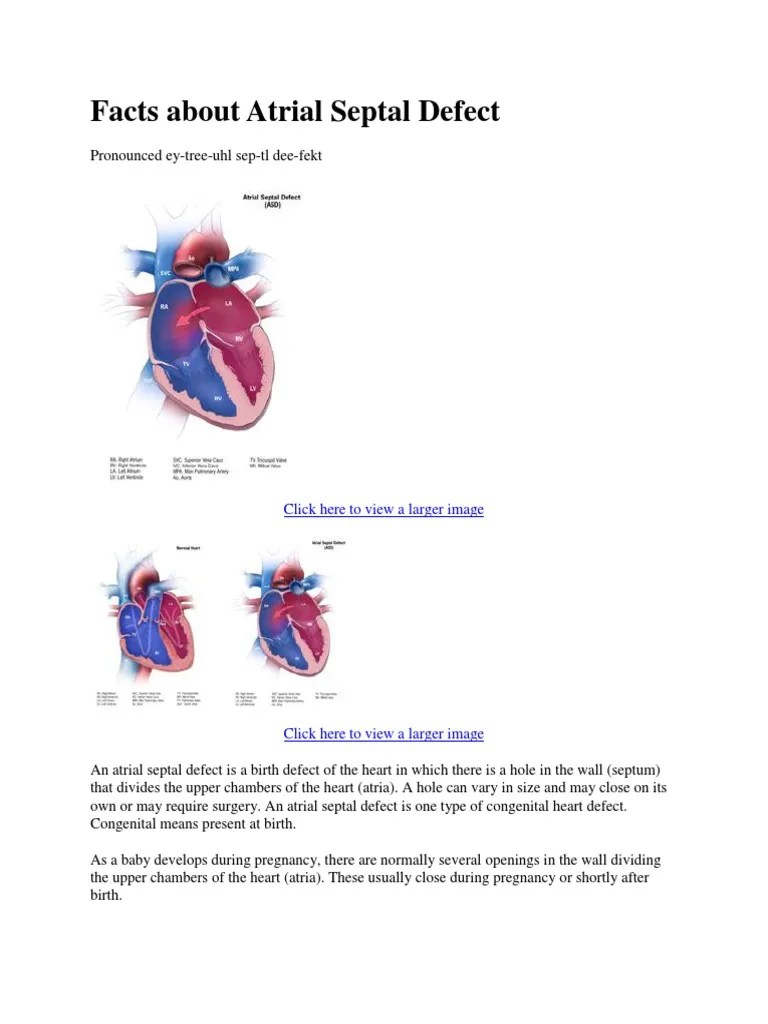 Facts About Atrial Septal Defect | PDF | Congenital Heart Defect | Heart