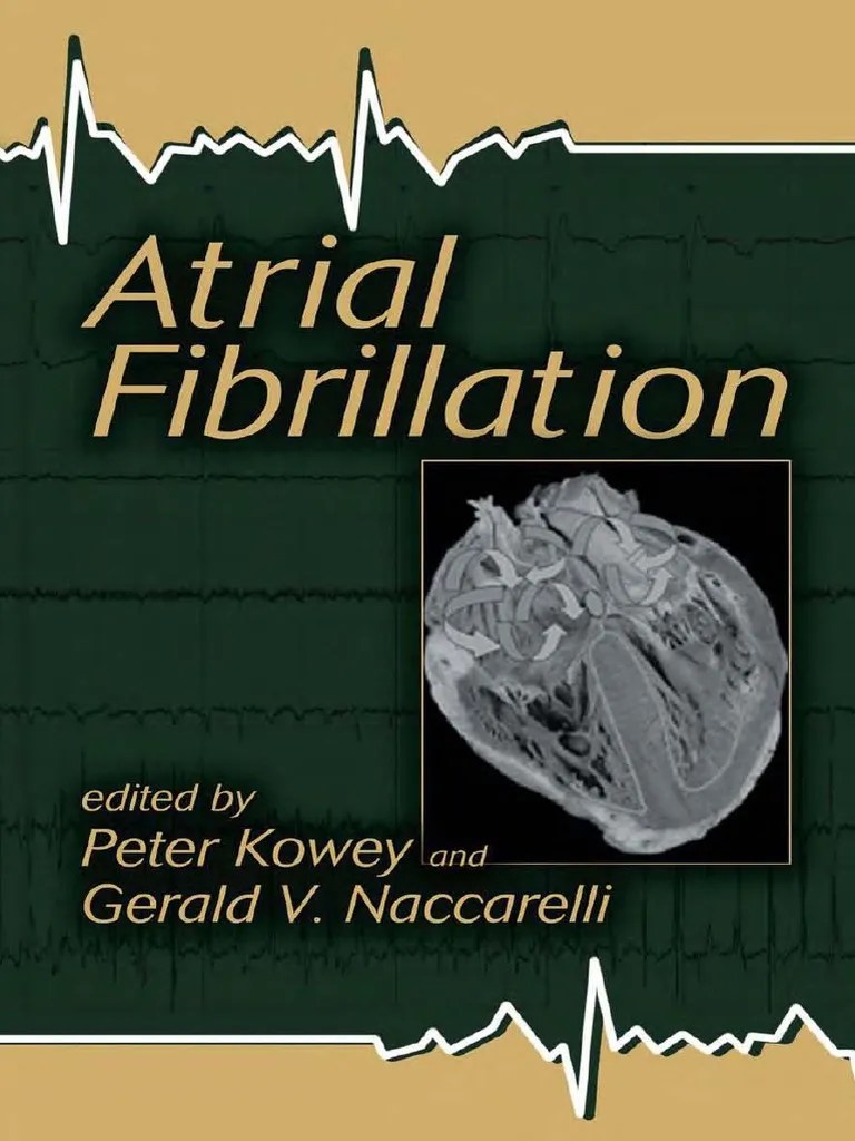 Atrial Fibrillation | PDF | Myocardial Infarction | Cardiac Arrhythmia