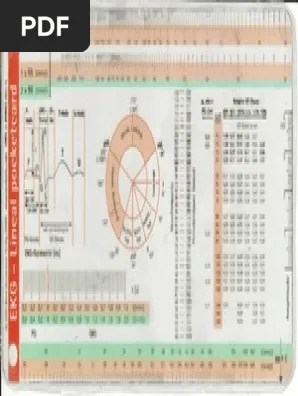 ekg ruler pdf