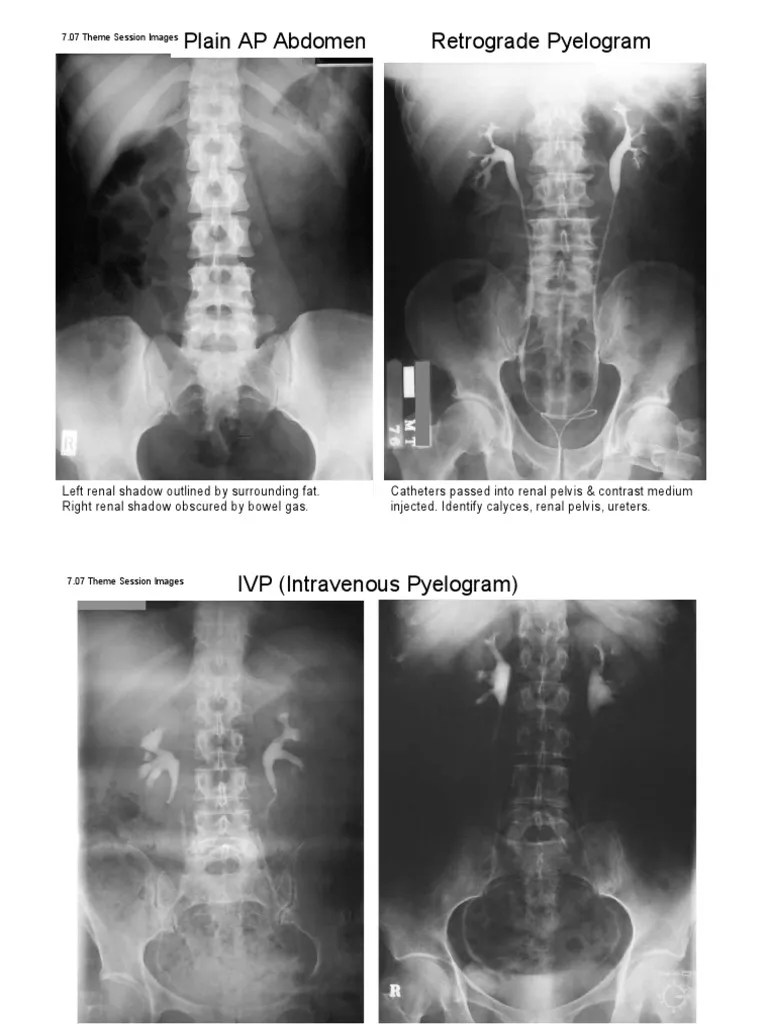 Urinary Tract Imaging | PDF