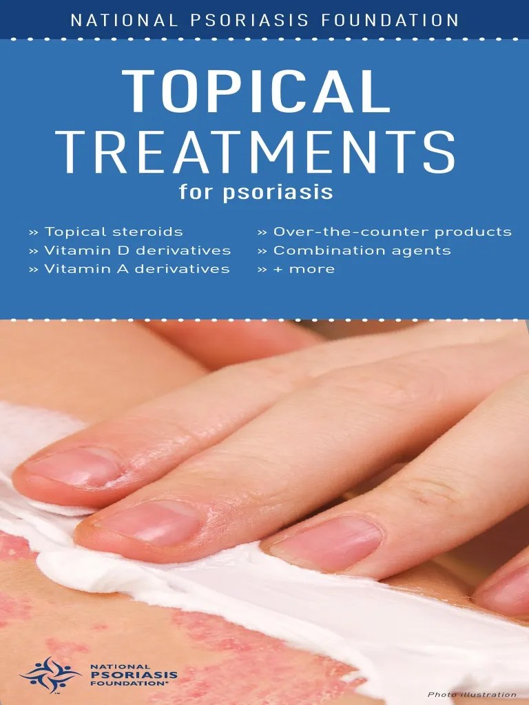Topical TX For Psoriasis | Psoriasis | Topical Medication | Free 30-day Trial | Scribd