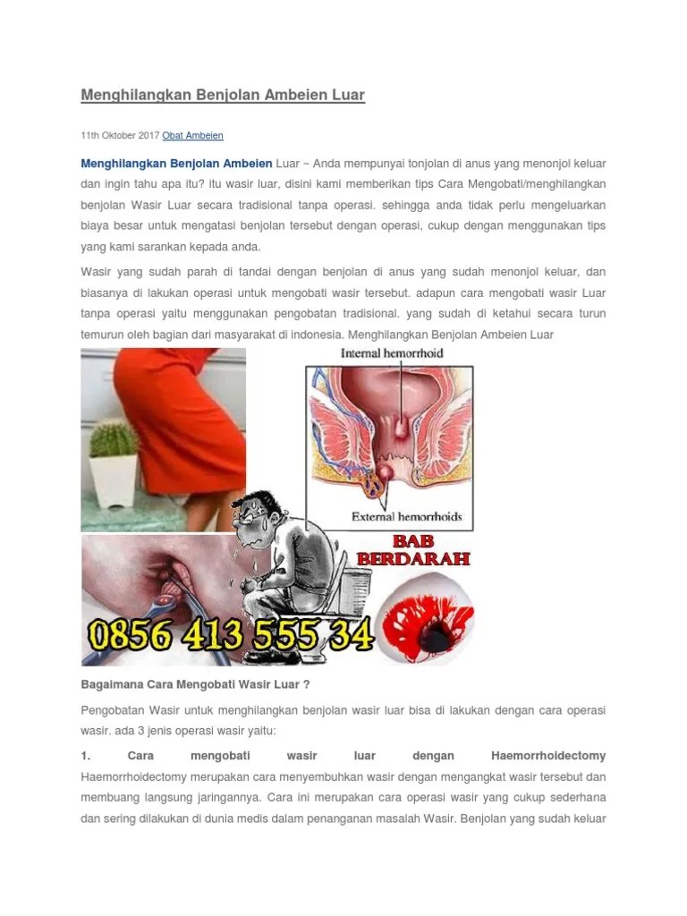 Menghilangkan Benjolan Ambeien Luar | PDF