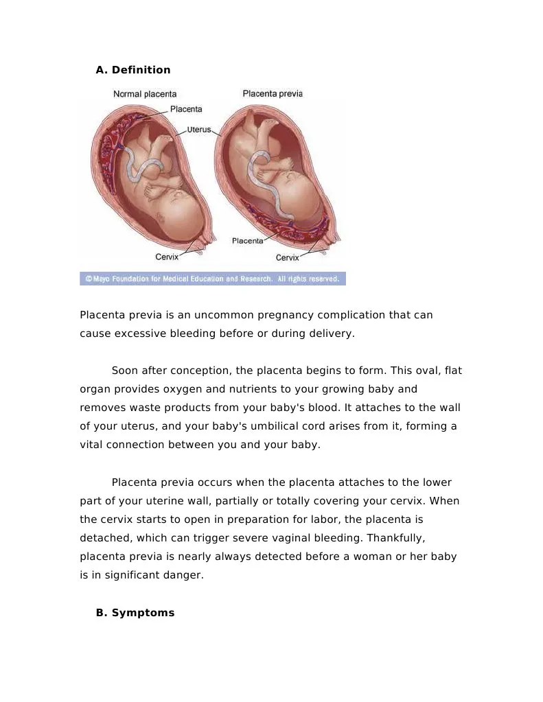 DR - Case Report Placenta Previa 2 | PDF | Childbirth | Placenta