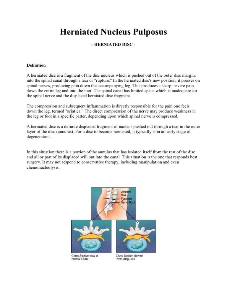 Herniated Nucleus Pulposus | PDF | Vertebral Column | Vertebra