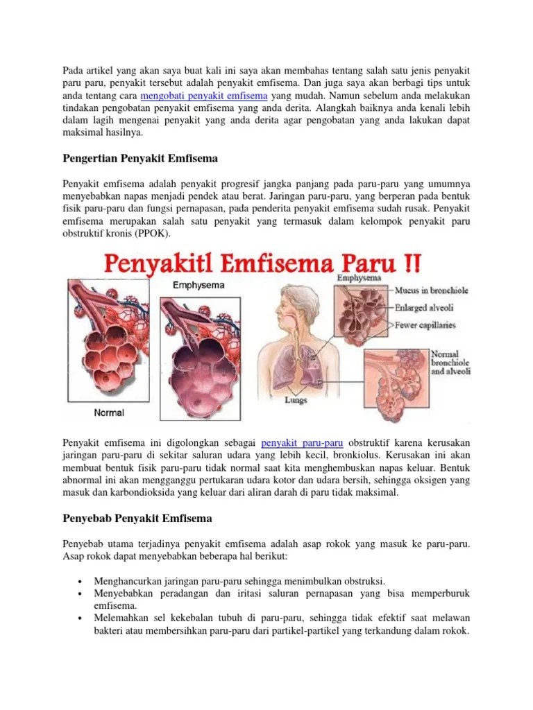 Cara Mengobati Penyakit Emfisema Yang Mudah | PDF