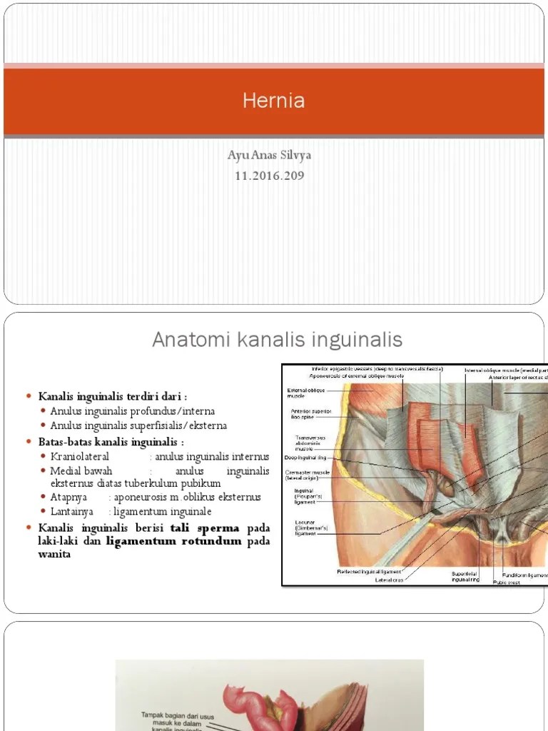 Hernia Pdf