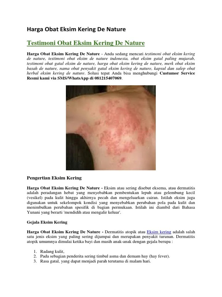 Harga Obat Eksim Kering de Nature | PDF