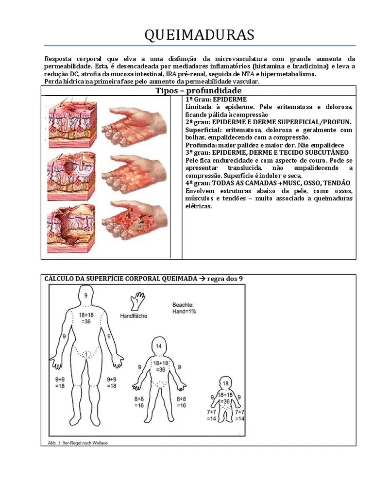 QUEIMADURAS.pdf | Queimadura | Pele
