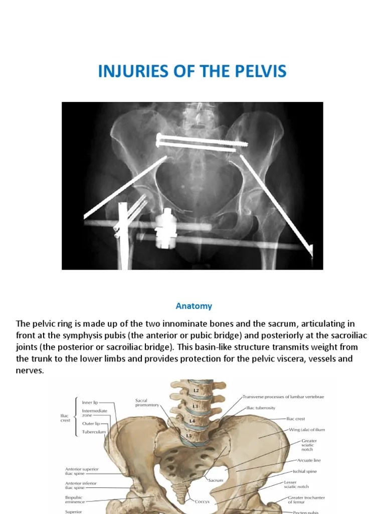 Pelvic injuries