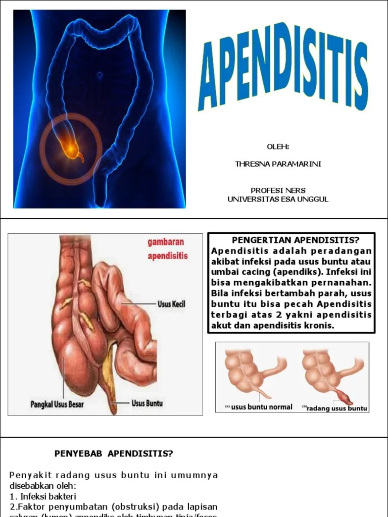 Bolak Balik Apenditis | PDF
