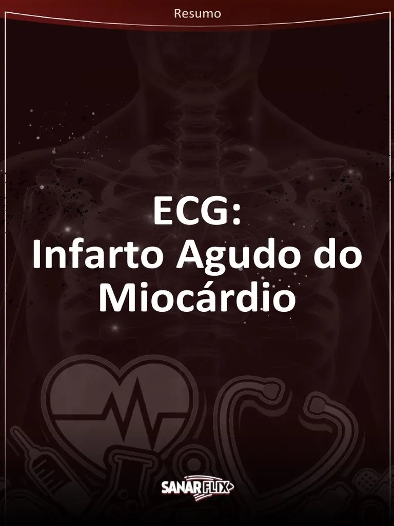 Resumo Infarto Agudo Do Miocardio | PDF | Infarto Do Miocárdio | Eletrocardiografia
