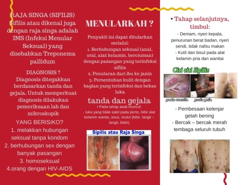 Ciri Ciri Penyakit Raja Singa Pada Wanita