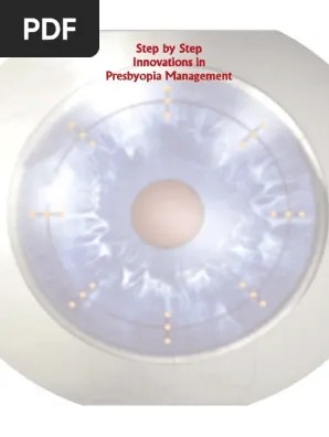 Amarjeet kaur hakum singh, profile picture. Step By Step Innovations In Presbyopia Management Pdf Visual Acuity Contact Lens