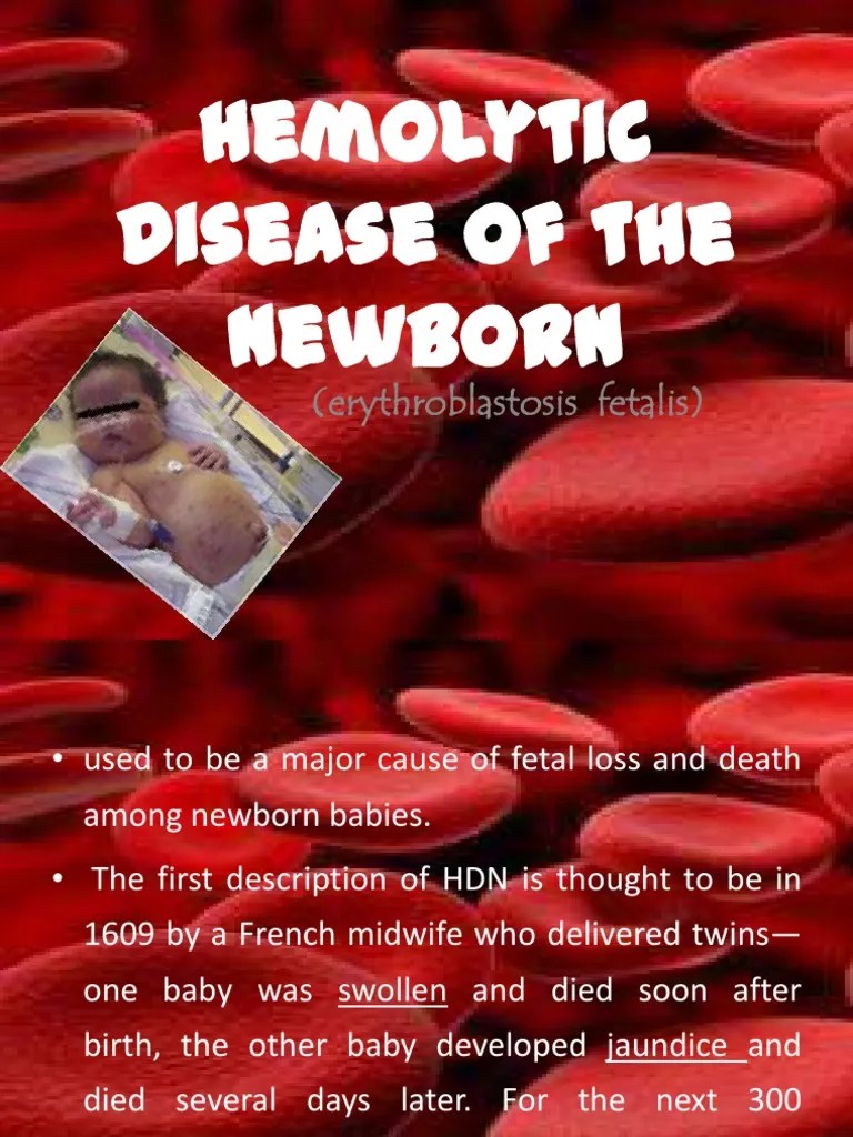 Hemolytic Disease Of The Newborn: (Erythroblastosis Fetalis) | PDF | Anatomy | Animal Anatomy