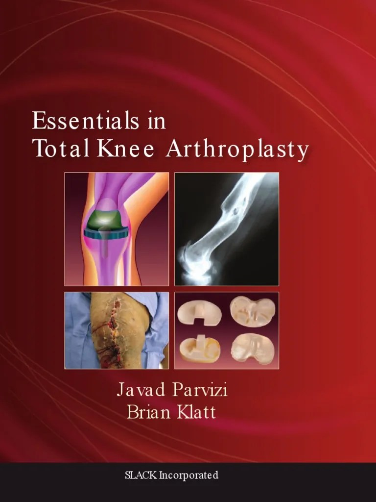 Essentials In Total Knee Arthroplasty | PDF | Human Leg | Knee