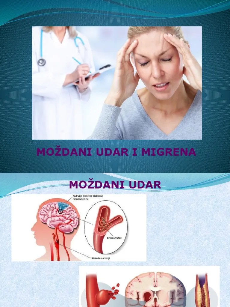 Mozdani Udar I Migrena | PDF