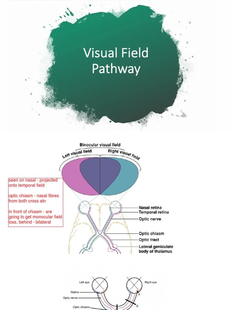 Optho Workshop One Visual Field Workshop | PDF | Language Arts ...