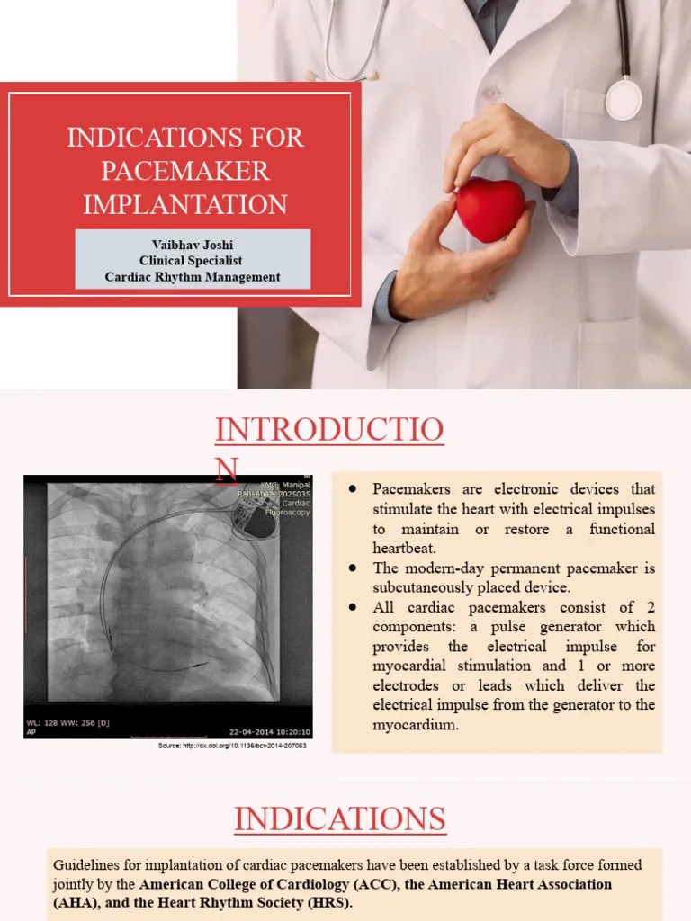 Pacemaker Implantation | PDF