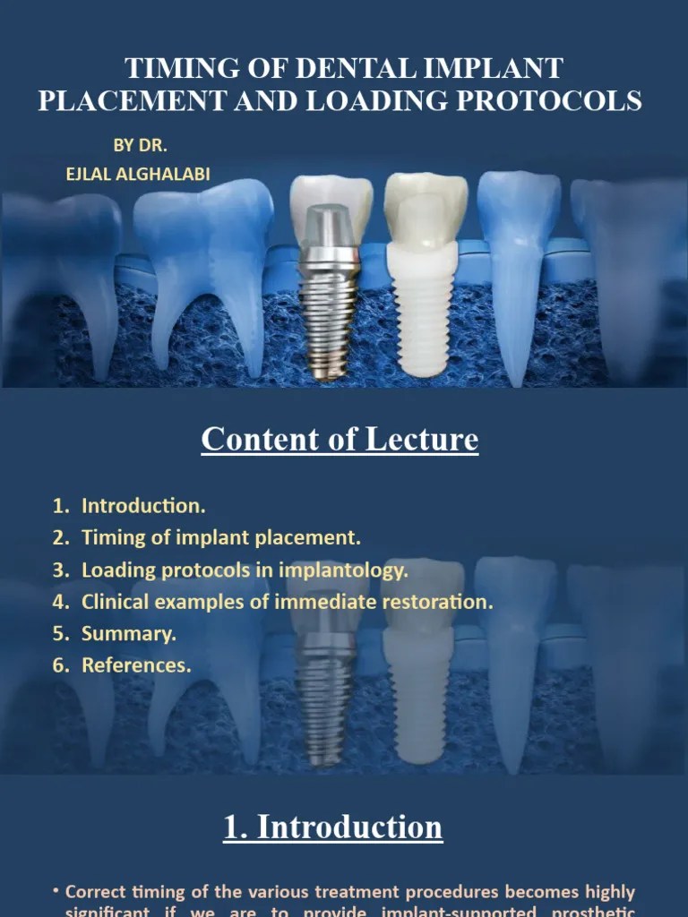 Timing Of Dental Implant Placement And Loading Protocols Completion ...