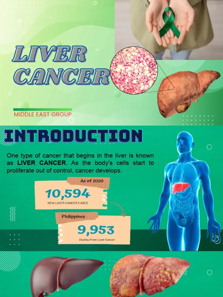 Liver Cancer | PDF