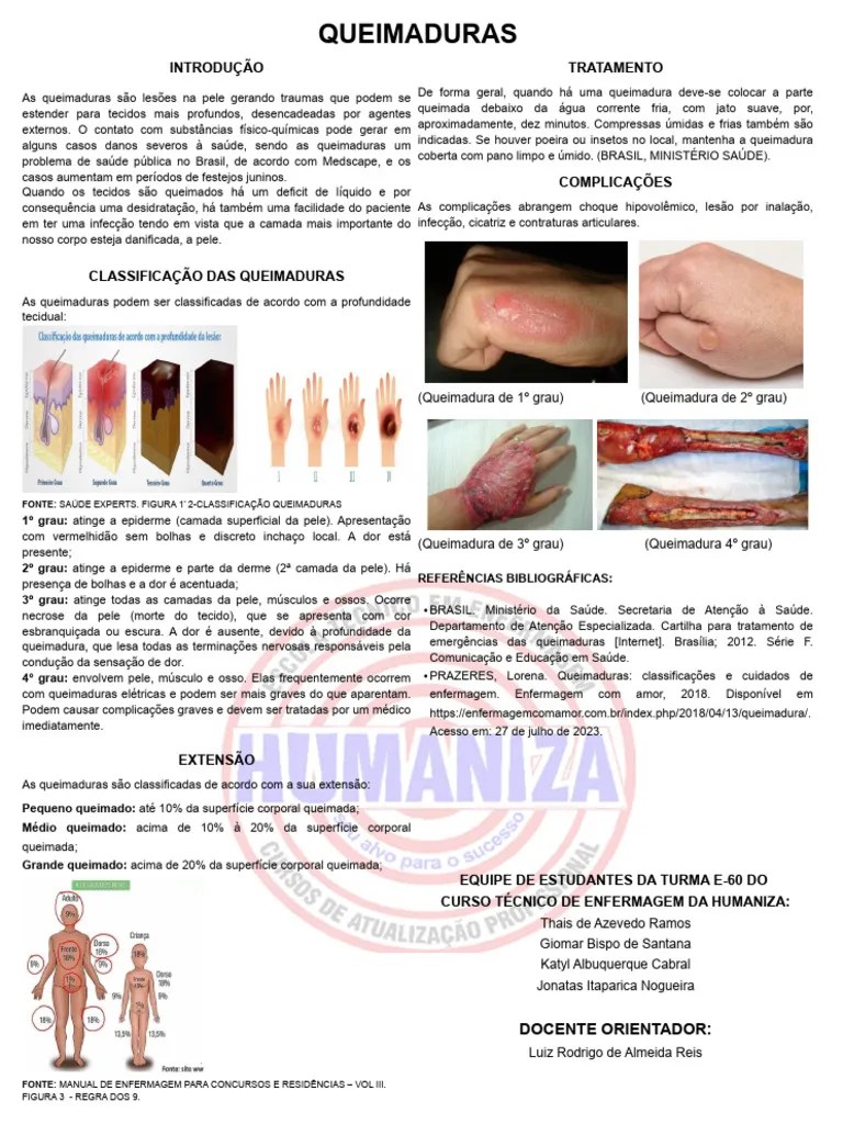 QUEIMADURAS | PDF | Queimadura | Pele
