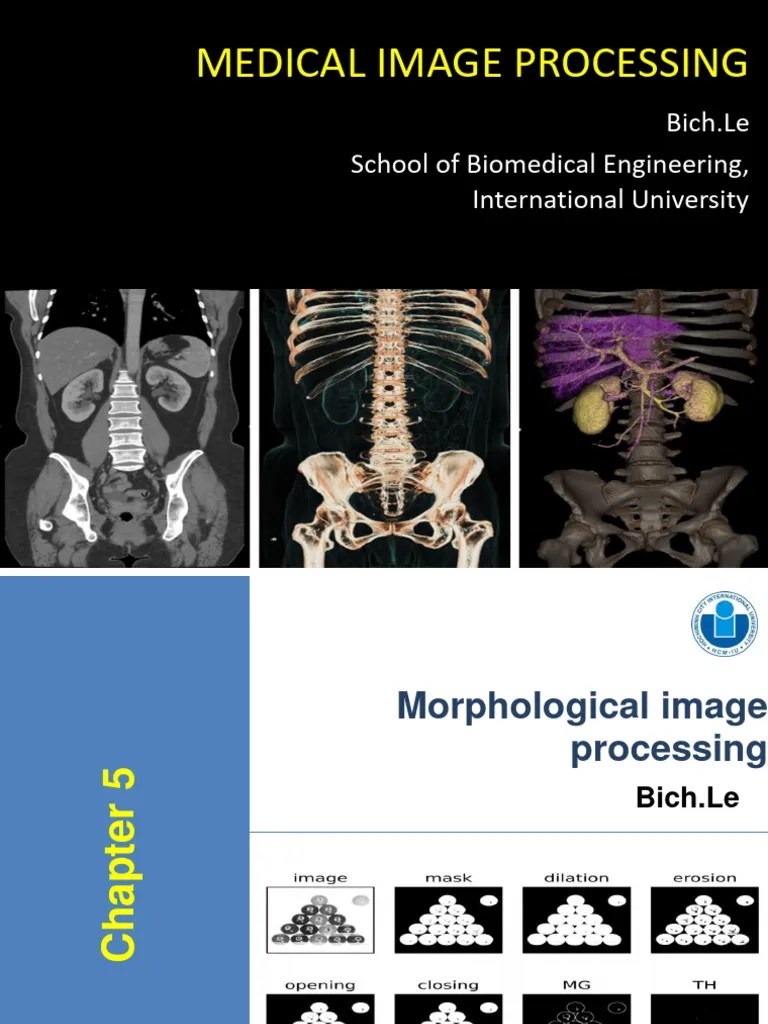 CHAP 5 Morphological Image Processing | PDF | Multidimensional Signal Processing | Computer Vision