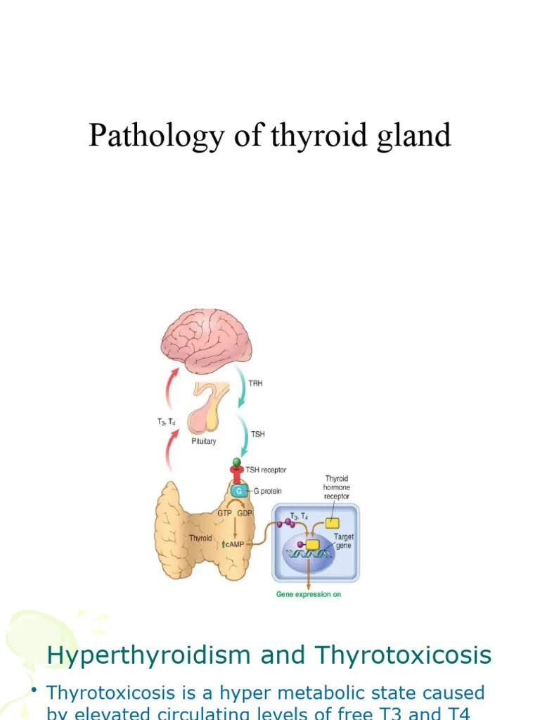 Thyroid Gland Pathology Final | PDF | Thyroid | Hyperthyroidism