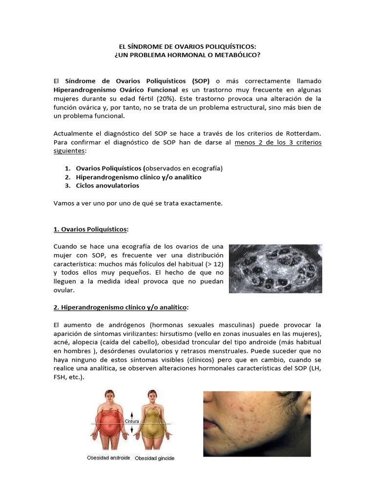SOP Síndrome De Ovario Poliquistico | PDF | Especialidades Medicas | Sistema Endocrino