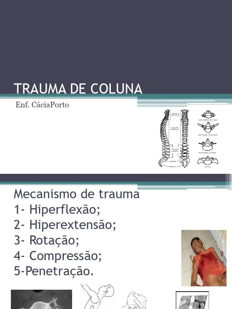 Aula 7- TRM | PDF