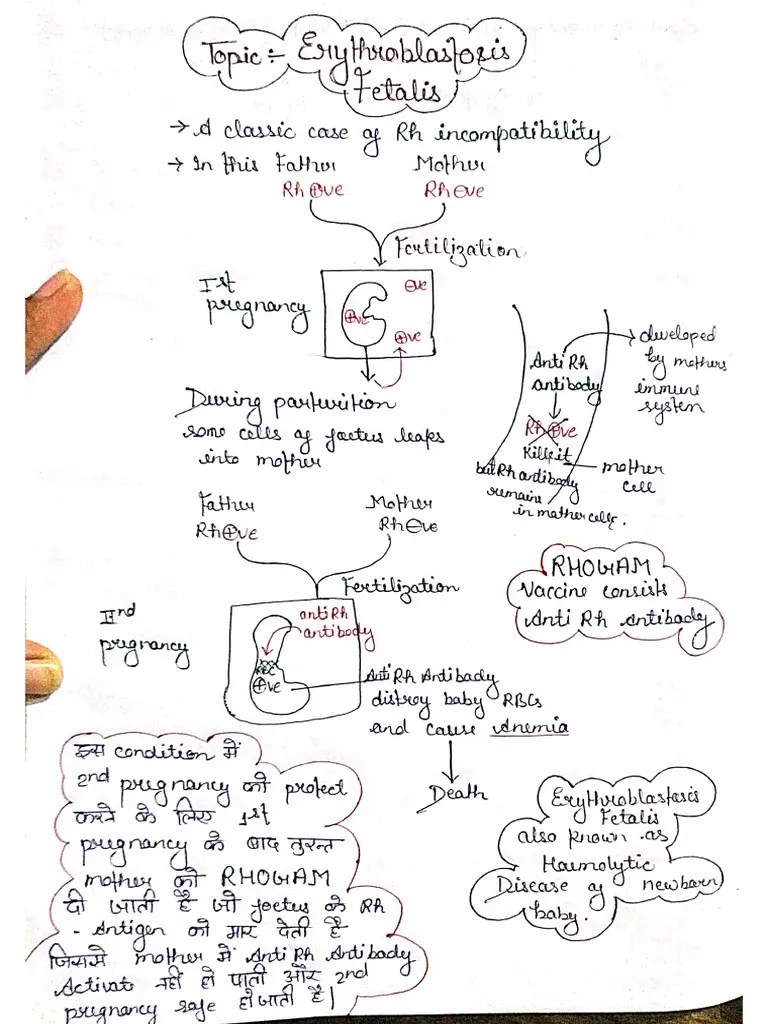Erythroblastosis Fetalis | PDF