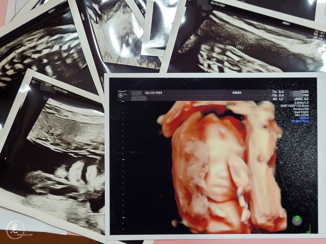 【懷孕紀錄】22W-32W：馬偕醫院高層次超音波、喝糖水、百日咳疫苗