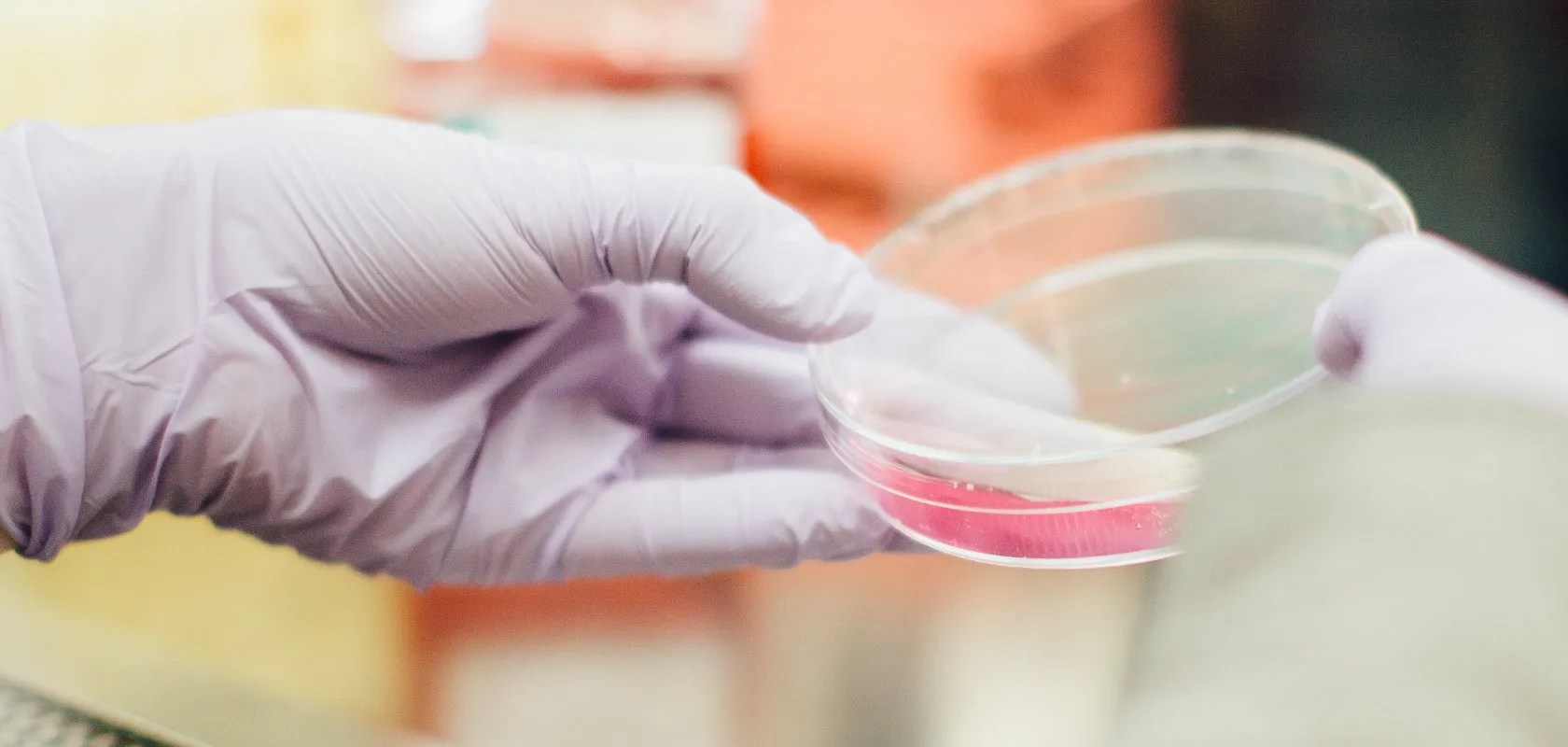 Testing for Black Mold ImmunoLytics Mold Testing Kit