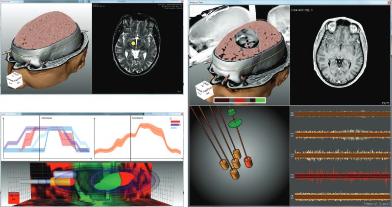 Publications Immvis - Amazing Dark Picture - Retina