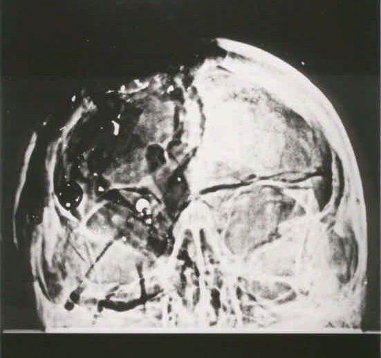 figure_2