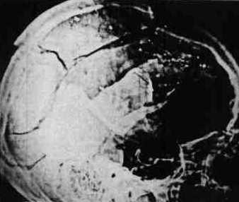 xrays1