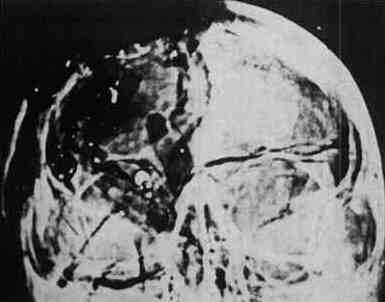 xrays2