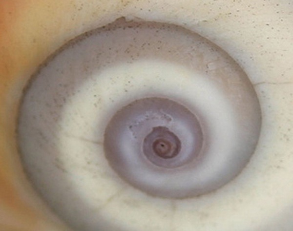 SnailShell76