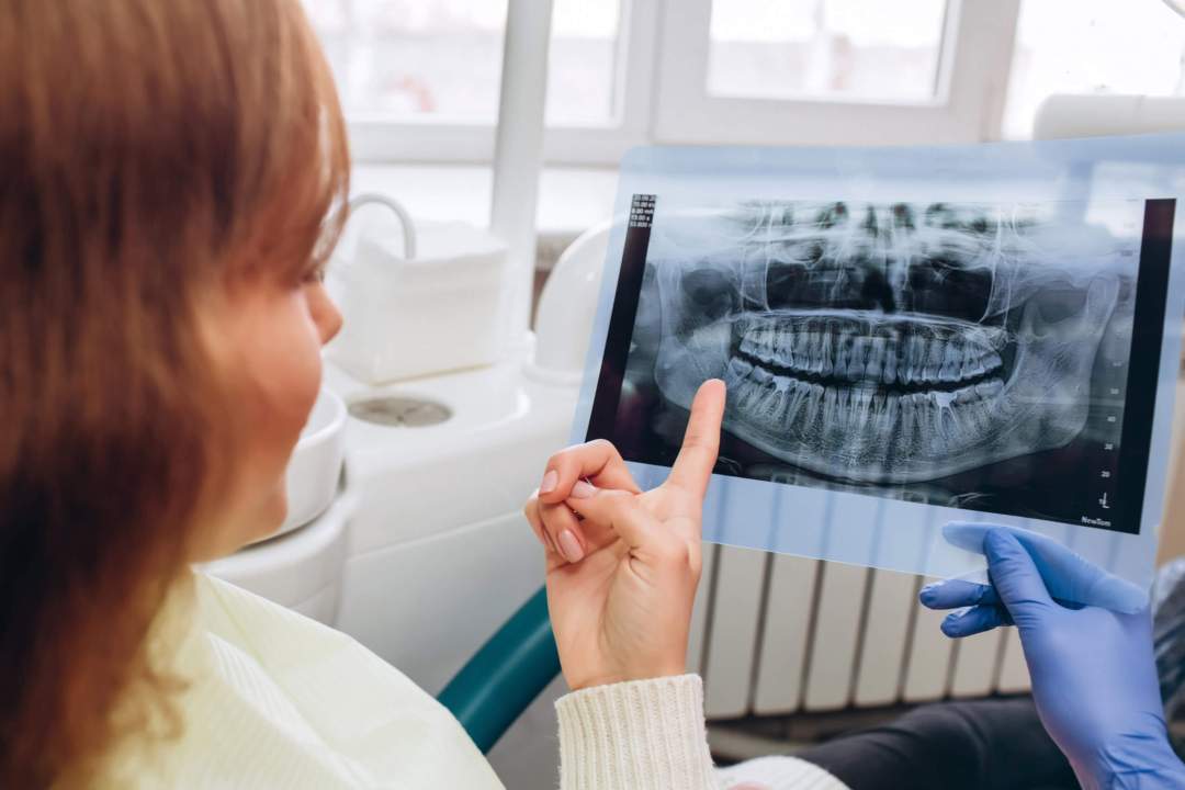 man receiving dental implants in Idaho