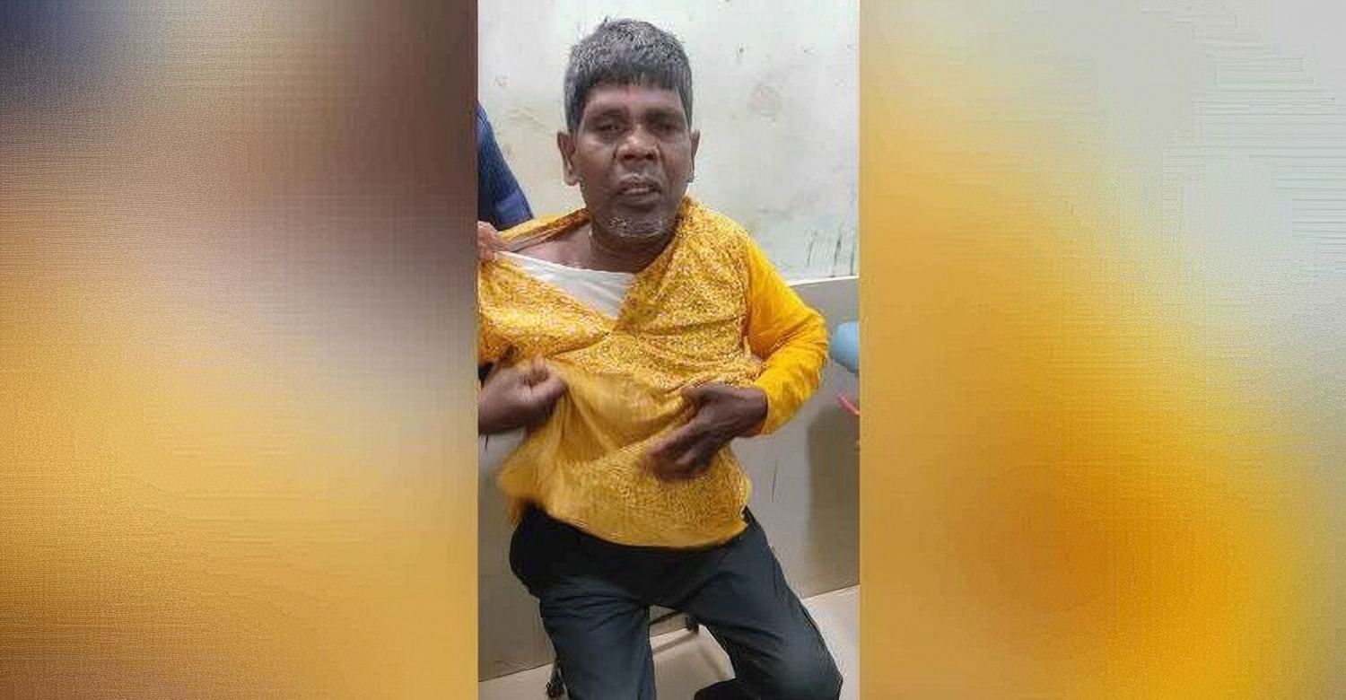 সড়ক দুর্ঘটনায় আহত ‘কাঁচা বাদাম’র গায়ক, হাসপাতালে ভর্তি