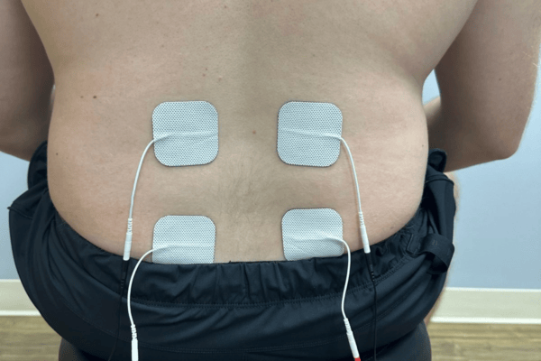 Lower Back Stim Placement