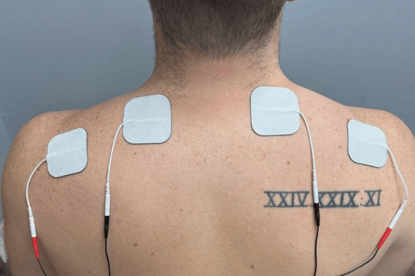 Neck-Shoulder Stim Placement