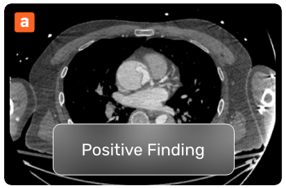 Cardiovascular Ai Solutions Aidoc - Geometric Pattern Collection - High Resolution Quality