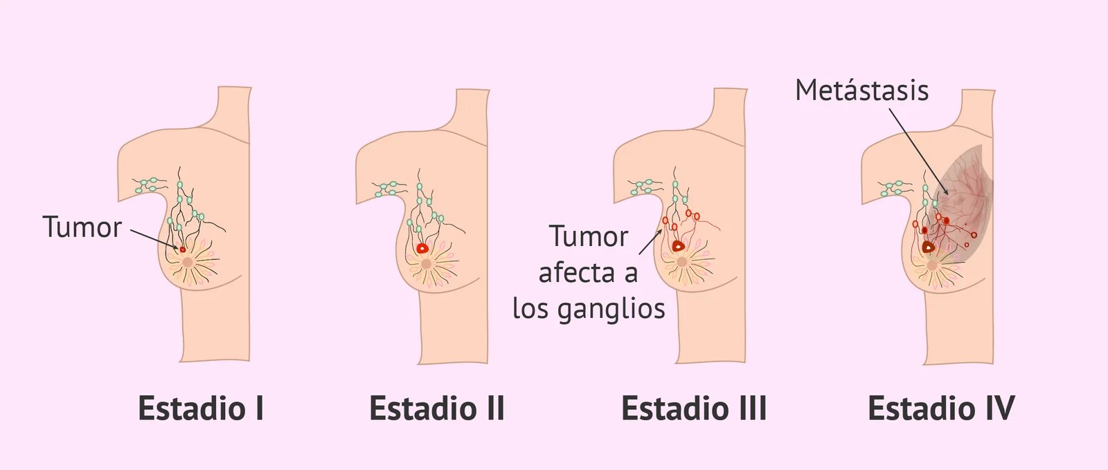Científicos argentinos descubren que método diagnóstico de cáncer de mama sirve en otros tumores