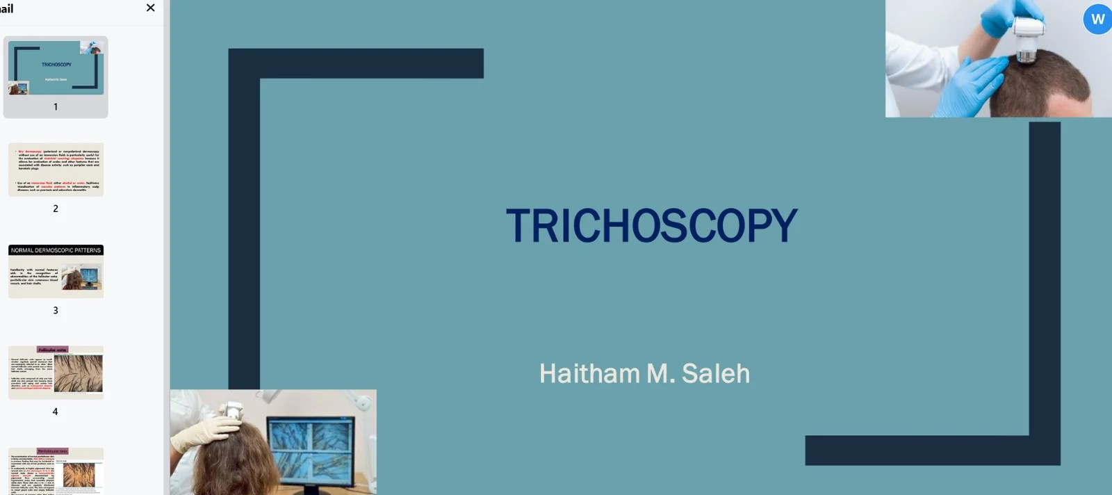 Trichoscopy