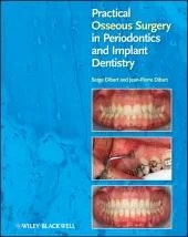 Download Book Practical Osseous Surgery in Periodontics and Implant Dentistry
