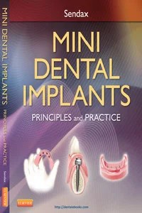 Mini Dental Implants: Principles and Practice