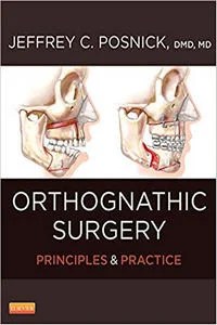Orthognathic Surgery: Principles and Practice , 2 Volume Set