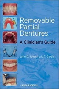 Removable Partial Dentures: A Clinician’s Guide